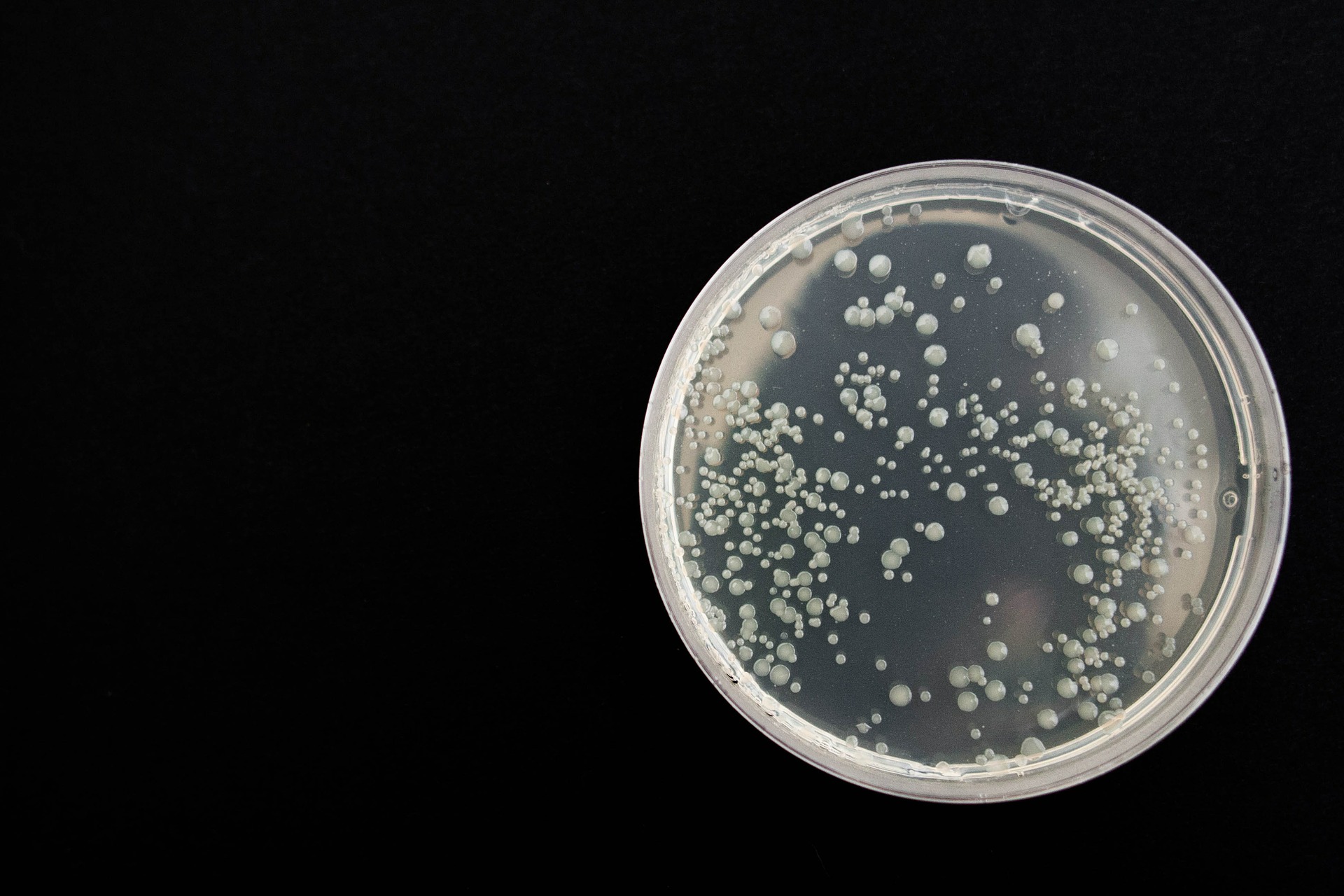 The most common gym germs